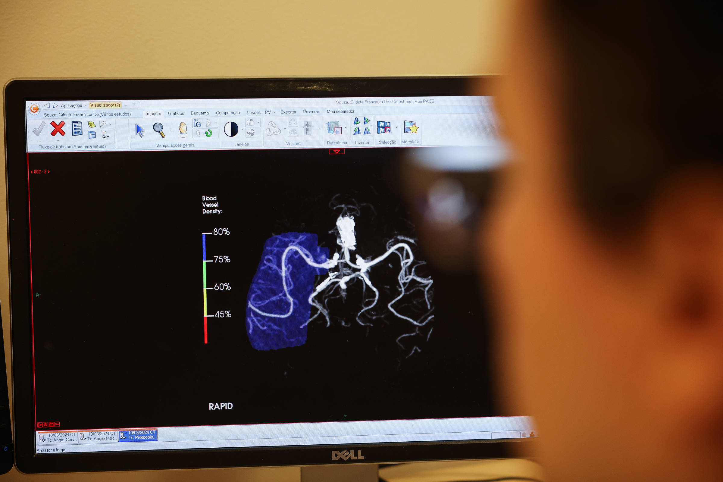 IA médica falha com pacientes leigos e pode agravar diagnósticos, indica estudo