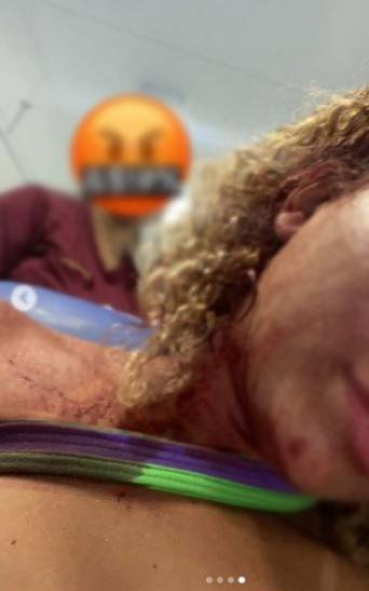 Mulher é agredida na cabeça após recusar cantada no Rio