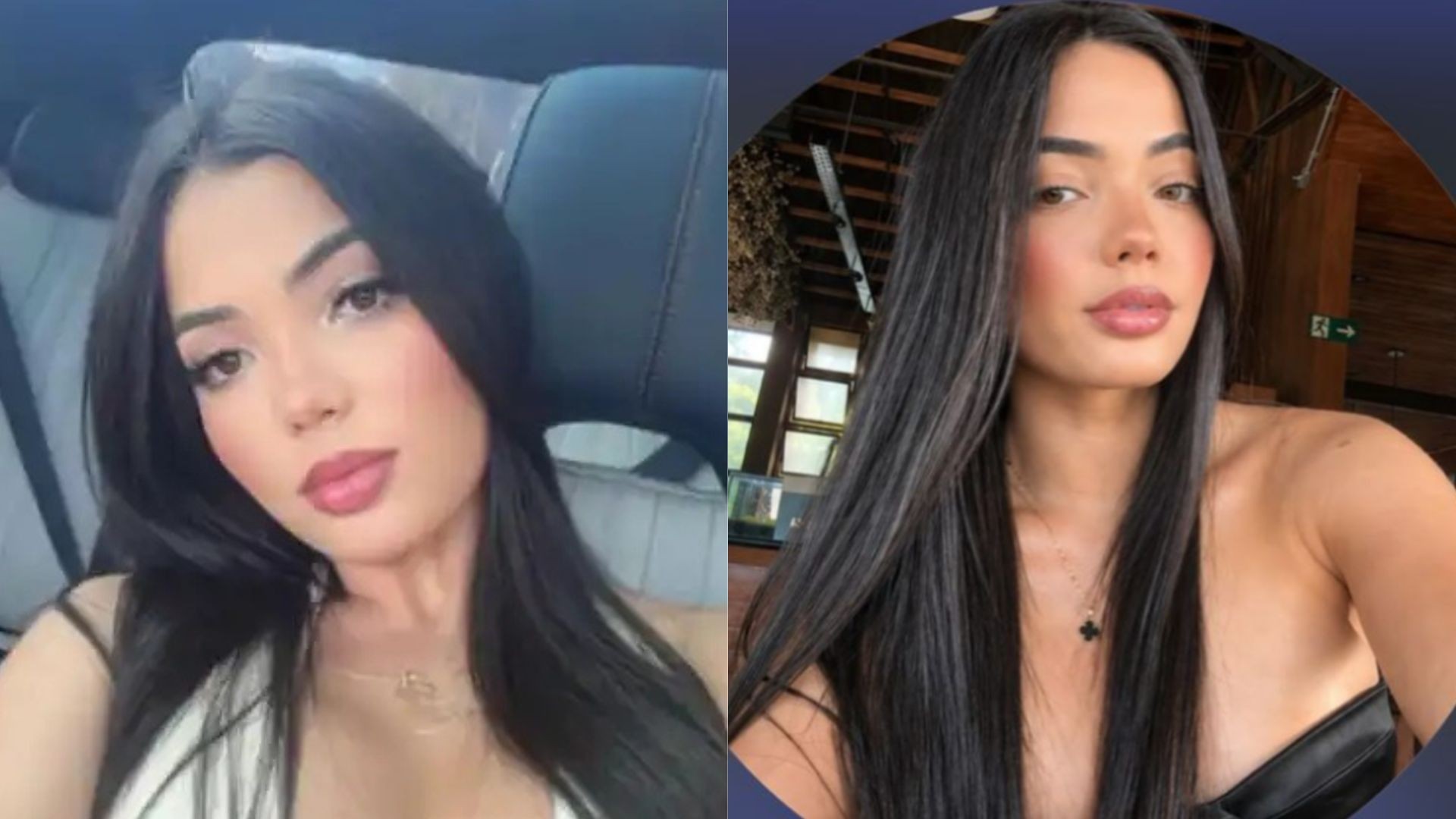 Jovem de 27 anos morre durante lipoaspiração em hospital de BH