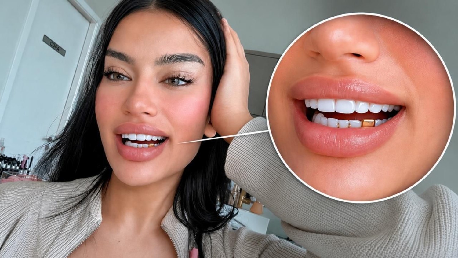 Influenciadora transforma aliança de noivado em grillz após traição